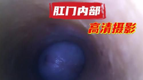 [推荐]超清摄像头拍摄肛门内部操逼全过程